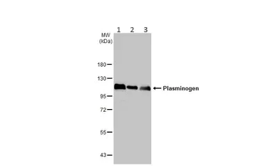 Western blot - Anti-Plasminogen antibody [HL2071] (AB308224)