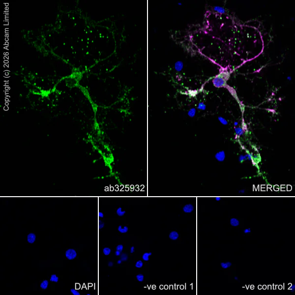 Immunocytochemistry/ Immunofluorescence - Anti-Plasmolipin antibody [EPR31074-536] (AB325932)