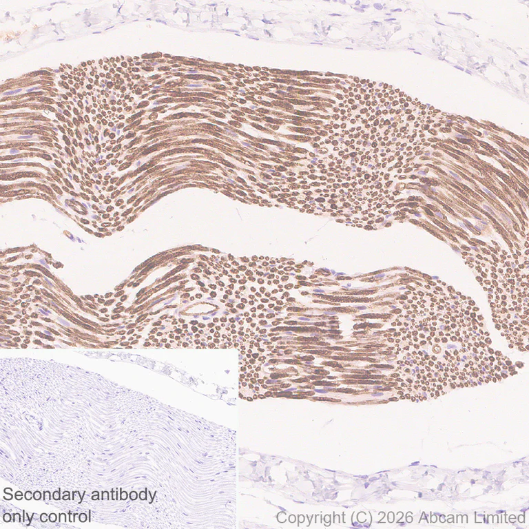 Immunohistochemistry (Formalin/PFA-fixed paraffin-embedded sections) - Anti-Plasmolipin antibody [EPR31074-536] (AB325932)