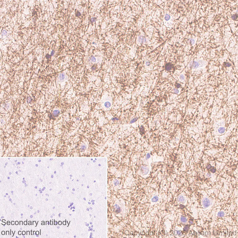 Immunohistochemistry (Formalin/PFA-fixed paraffin-embedded sections) - Anti-Plasmolipin antibody [EPR31074-536] (AB325932)