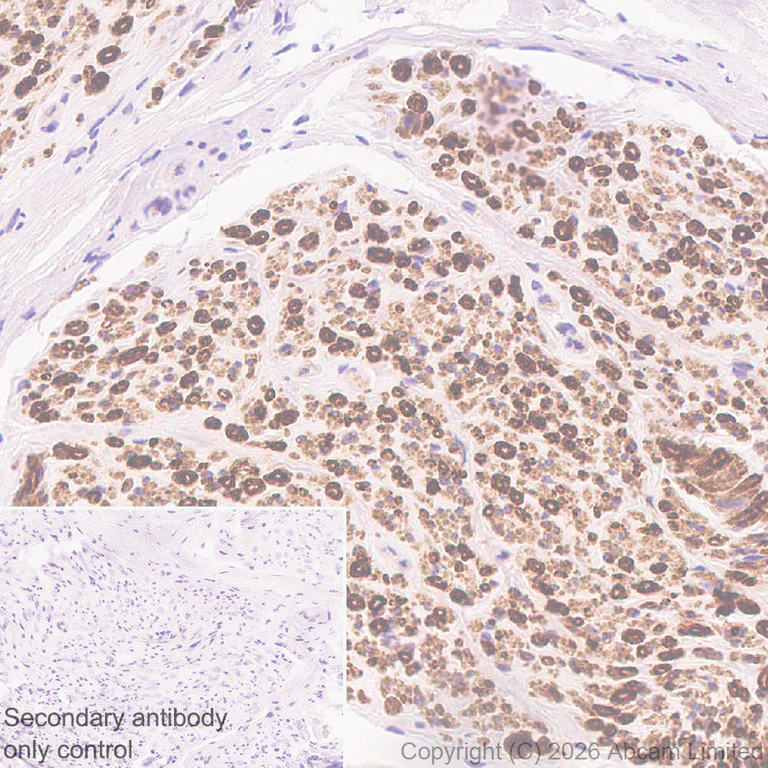 Immunohistochemistry (Formalin/PFA-fixed paraffin-embedded sections) - Anti-Plasmolipin antibody [EPR31074-536] (AB325932)