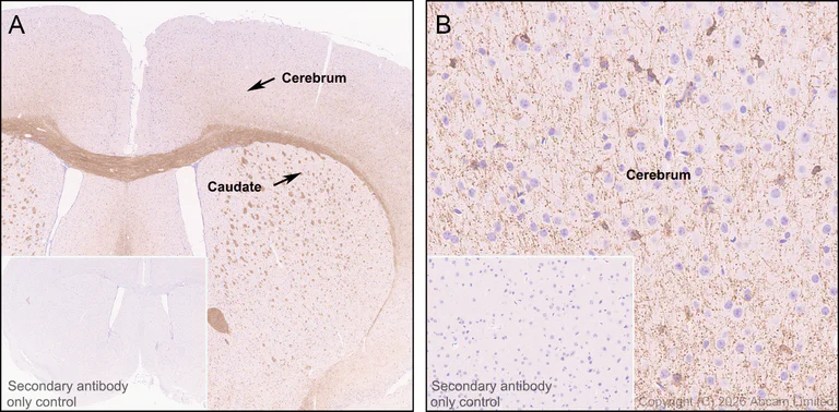 Immunohistochemistry (Formalin/PFA-fixed paraffin-embedded sections) - Anti-Plasmolipin antibody [EPR31074-536] (AB325932)