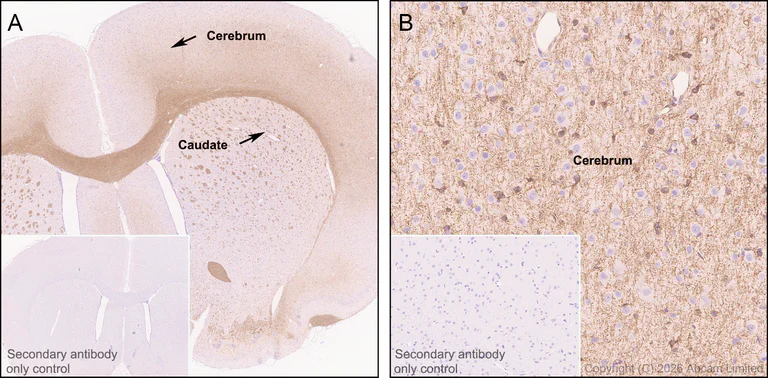 Immunohistochemistry (Formalin/PFA-fixed paraffin-embedded sections) - Anti-Plasmolipin antibody [EPR31074-536] (AB325932)