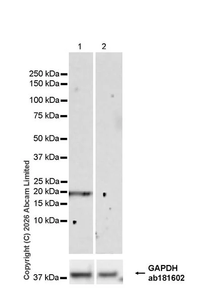 Western blot - Anti-Plasmolipin antibody [EPR31074-536] (AB325932)