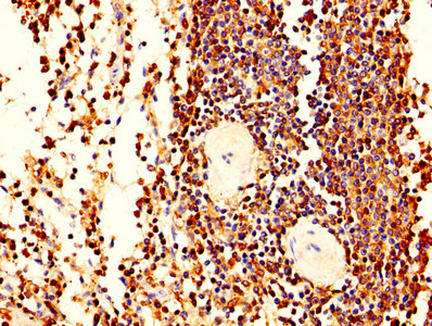 Immunohistochemistry (Formalin/PFA-fixed paraffin-embedded sections) - Anti-Plastin L antibody (AB236104)