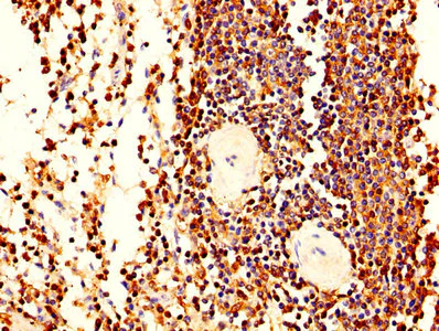 Immunohistochemistry (Formalin/PFA-fixed paraffin-embedded sections) - Anti-Plastin L antibody (AB236104)