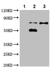 Immunoprecipitation - Anti-Plastin L antibody (AB236104)