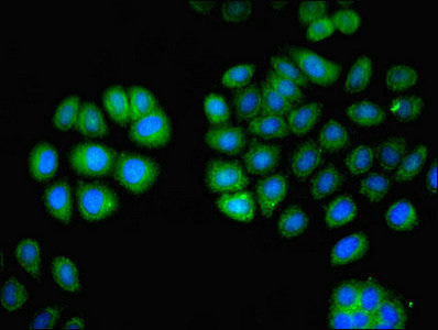 Immunocytochemistry/ Immunofluorescence - Anti-Plastin L antibody (AB236280)