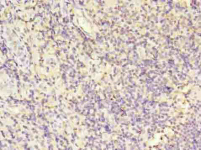 Immunohistochemistry (Formalin/PFA-fixed paraffin-embedded sections) - Anti-Plastin L antibody (AB236280)