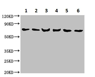 Western blot - Anti-Plastin L antibody (AB236280)