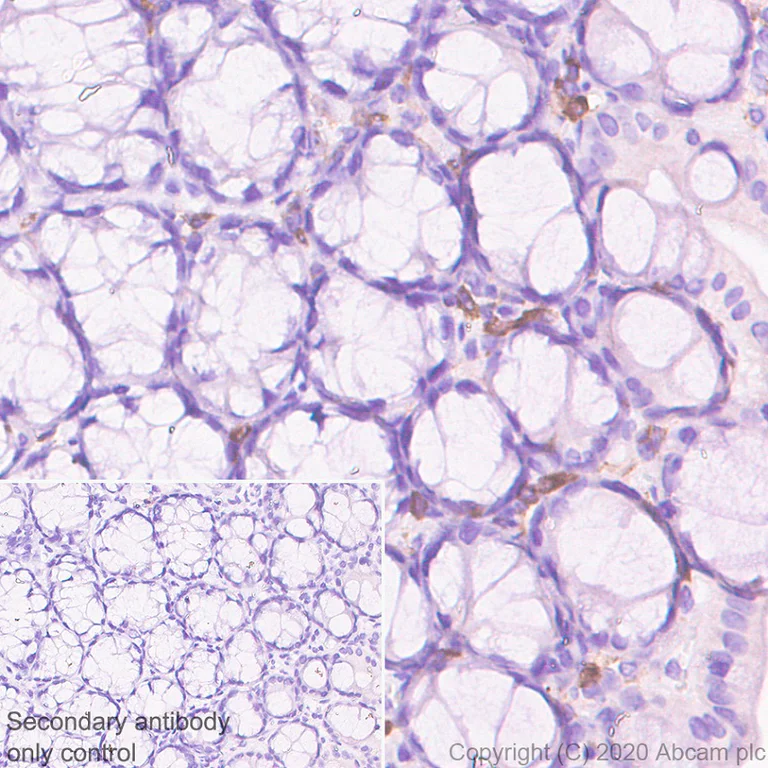 Immunohistochemistry (Formalin/PFA-fixed paraffin-embedded sections) - Anti-Plastin L antibody [EPR4277] (AB109124)