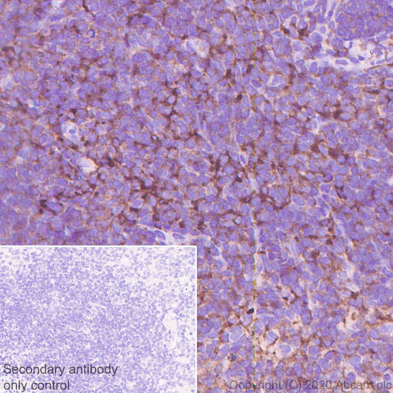Immunohistochemistry (Formalin/PFA-fixed paraffin-embedded sections) - Anti-Plastin L antibody [EPR4277] (AB109124)