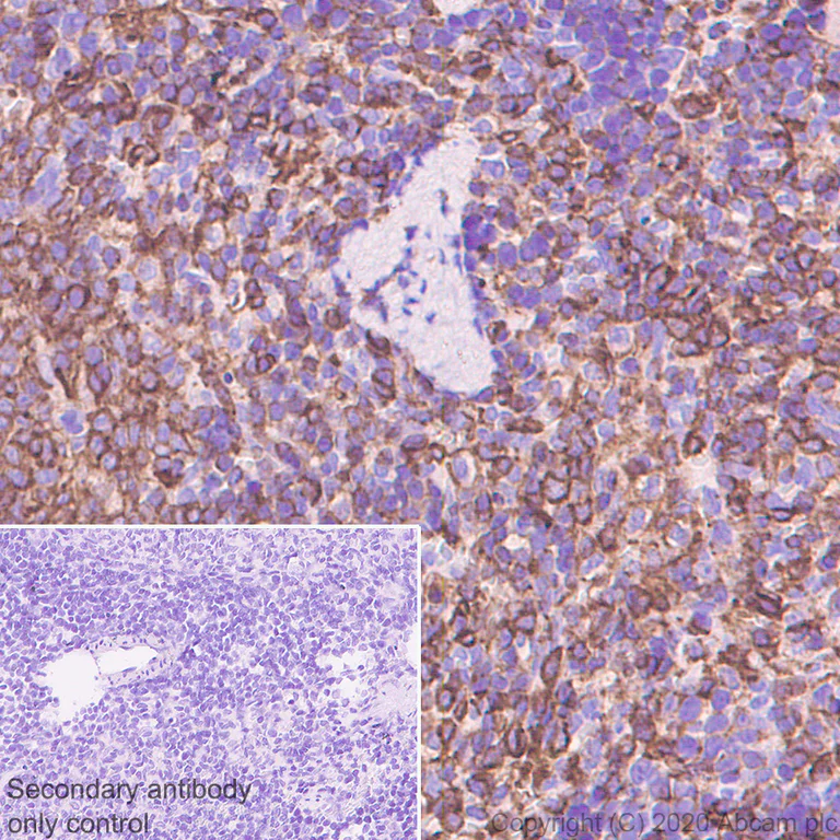 Immunohistochemistry (Formalin/PFA-fixed paraffin-embedded sections) - Anti-Plastin L antibody [EPR4277] (AB109124)