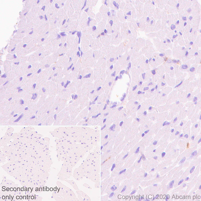 Immunohistochemistry (Formalin/PFA-fixed paraffin-embedded sections) - Anti-Plastin L antibody [EPR4277] (AB109124)