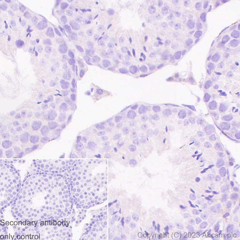 Immunohistochemistry (Formalin/PFA-fixed paraffin-embedded sections) - Anti-Plastin L antibody [EPR4277] (AB109124)