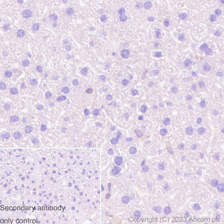 Immunohistochemistry (Formalin/PFA-fixed paraffin-embedded sections) - Anti-Plastin L antibody [EPR4277] (AB109124)