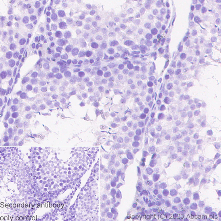 Immunohistochemistry (Formalin/PFA-fixed paraffin-embedded sections) - Anti-Plastin L antibody [EPR4277] (AB109124)