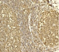Immunohistochemistry (Formalin/PFA-fixed paraffin-embedded sections) - Anti-Plastin L antibody [EPR4277] (AB109124)