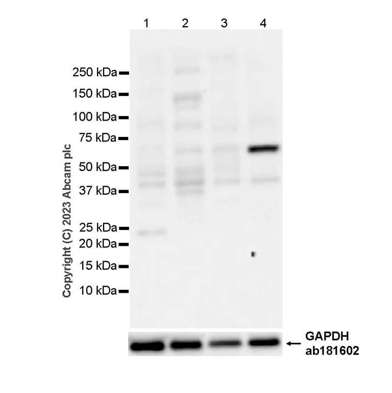Western blot - Anti-Plastin L antibody [EPR4277] (AB109124)