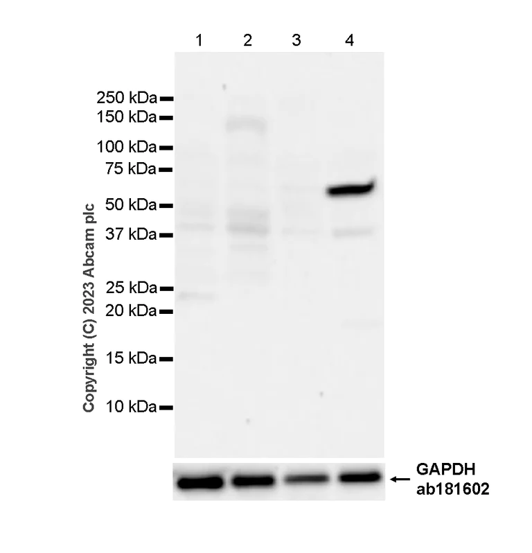 Western blot - Anti-Plastin L antibody [EPR4277] (AB109124)