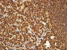 Immunohistochemistry (Formalin/PFA-fixed paraffin-embedded sections) - Anti-Plastin L antibody [EPR4278] - BSA and Azide free (AB247773)