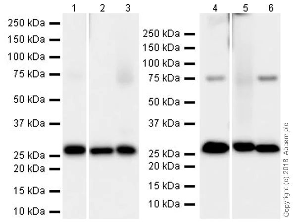 Western blot - Anti-PLBD2 antibody [EPR21742] (AB216866)