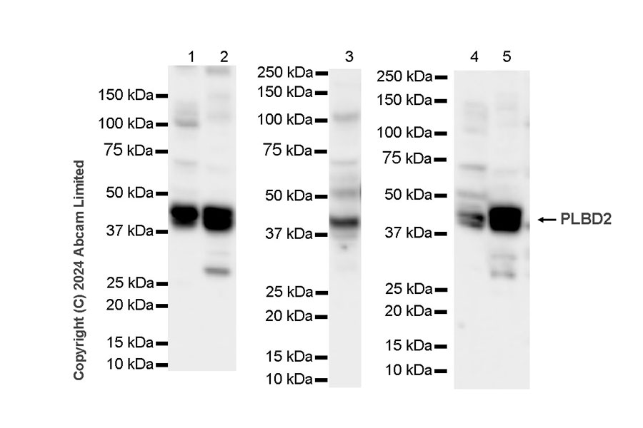 Western blot - Anti-PLBD2 antibody [IGX4128H] (AB213295)
