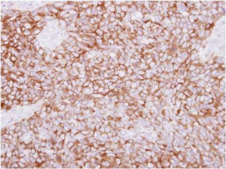 Immunohistochemistry (Formalin/PFA-fixed paraffin-embedded sections) - Anti-PLCD1 antibody (AB154610), expandable thumbnail