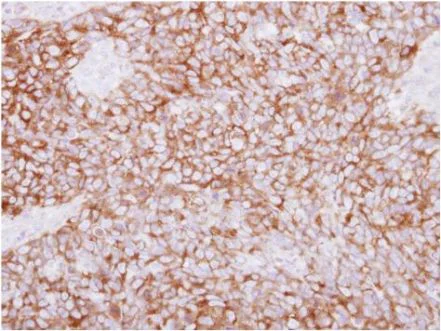 Immunohistochemistry (Formalin/PFA-fixed paraffin-embedded sections) - Anti-PLCD1 antibody (AB154610)