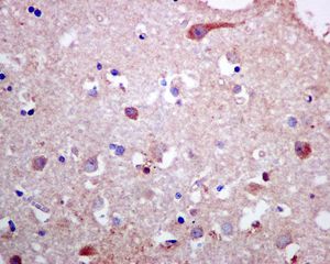 Immunohistochemistry (Formalin/PFA-fixed paraffin-embedded sections) - Anti-PLCD1 antibody [EPR8430] (AB134936), expandable thumbnail