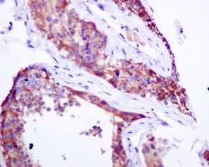 Immunohistochemistry (Formalin/PFA-fixed paraffin-embedded sections) - Anti-PLCD1 antibody [EPR8430] (AB134936), expandable thumbnail