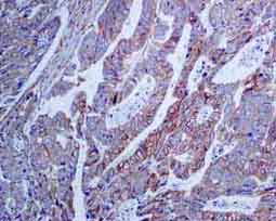 Immunohistochemistry (Formalin/PFA-fixed paraffin-embedded sections) - Anti-PLCG 2 antibody [EPR5914-34] (AB133522), expandable thumbnail
