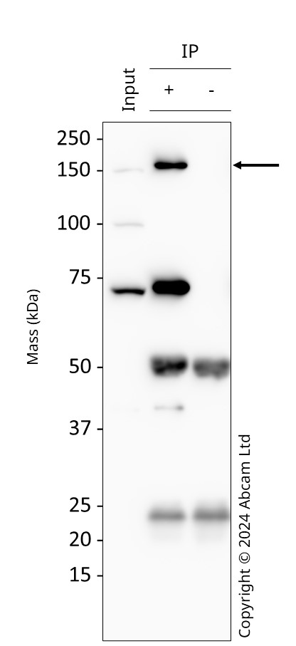 Immunoprecipitation - Anti-PLCG 2 antibody [EPR5914-34] (AB133522), expandable thumbnail