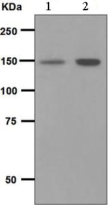 Western blot - Anti-PLCG 2 antibody [EPR5914-34] (AB133522), expandable thumbnail