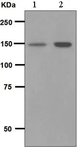 Western blot - Anti-PLCG 2 antibody [EPR5914-34] (AB133522)