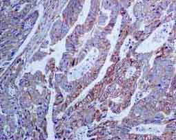 Immunohistochemistry (Formalin/PFA-fixed paraffin-embedded sections) - Anti-PLCG 2 antibody [EPR5914-34] - BSA and Azide free (AB248535)