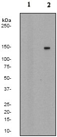 Western blot - Anti-PLCG 2 (phospho Y1217) antibody [EP1404Y] (AB52610), expandable thumbnail