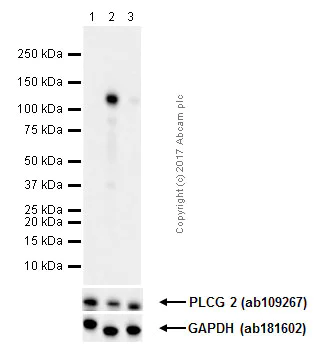 Western blot - Anti-PLCG 2 (phospho Y1217) antibody [EP1404Y] (AB52610)