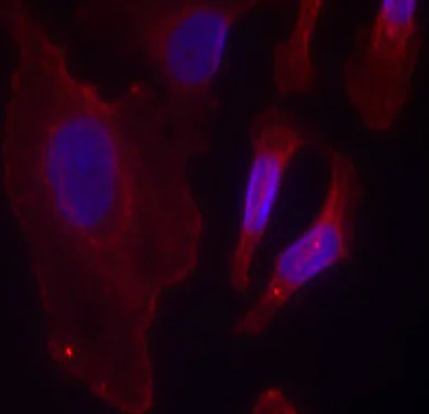 Immunocytochemistry/ Immunofluorescence - Anti-PLCG 2 (phospho Y753) antibody (AB75659)