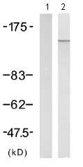 Western blot - Anti-PLCG 2 (phospho Y753) antibody (AB75659)
