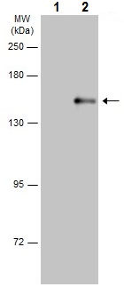 Western blot - Anti-PLCG 2 (phospho Y759) antibody (AB227001), expandable thumbnail