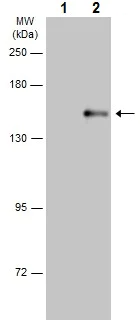 Western blot - Anti-PLCG 2 (phospho Y759) antibody (AB227001)