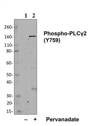 Western blot - Anti-PLCG 2 (phospho Y759) antibody [PLCG2Y759-G3] (AB278678), expandable thumbnail