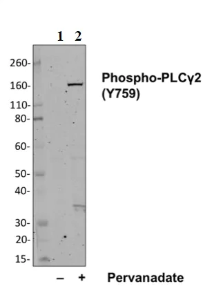Western blot - Anti-PLCG 2 (phospho Y759) antibody [PLCG2Y759-G3] (AB278678)