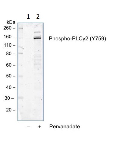 Western blot - Anti-PLCG 2 (phospho Y759) antibody [PLCG2Y759-G3] (AB278678), expandable thumbnail