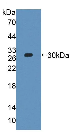 Western blot - Anti-PLCH2 antibody (AB231286)