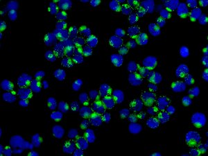 Immunocytochemistry/ Immunofluorescence - Anti-PLCL1 antibody [EPR11213] (AB157200)