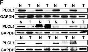 Western blot - Anti-PLCL1 antibody [EPR11213] (AB157200)