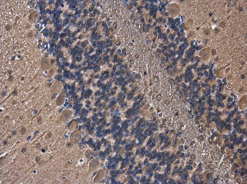 Immunohistochemistry (Formalin/PFA-fixed paraffin-embedded sections) - Anti-PLCL1 antibody - N-terminal (AB228627)