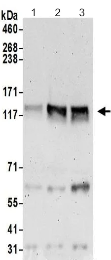 Western blot - Anti-PLCL2 antibody - C-terminal (AB199852)